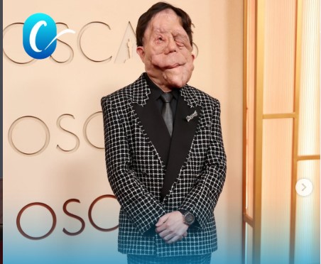 🎥 ЦЕЛ ЖИВОТ СЕ СООЧУВАЛ СО ПРЕДРАСУДИ Актерот Адам Пирсон ги руши бариерите во Холивуд